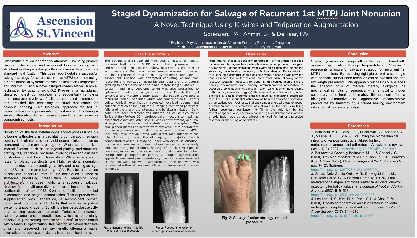 Poster for staged dynamization nonunion salvage technique